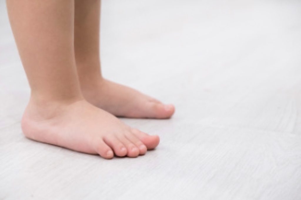 Causes and Symptoms of Flat Feet in Babies